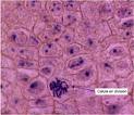 Preparación microscòpica-mitosis