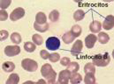 Linfocitos